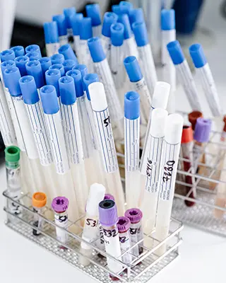 Empty vials sit on the counter in a medical lab.